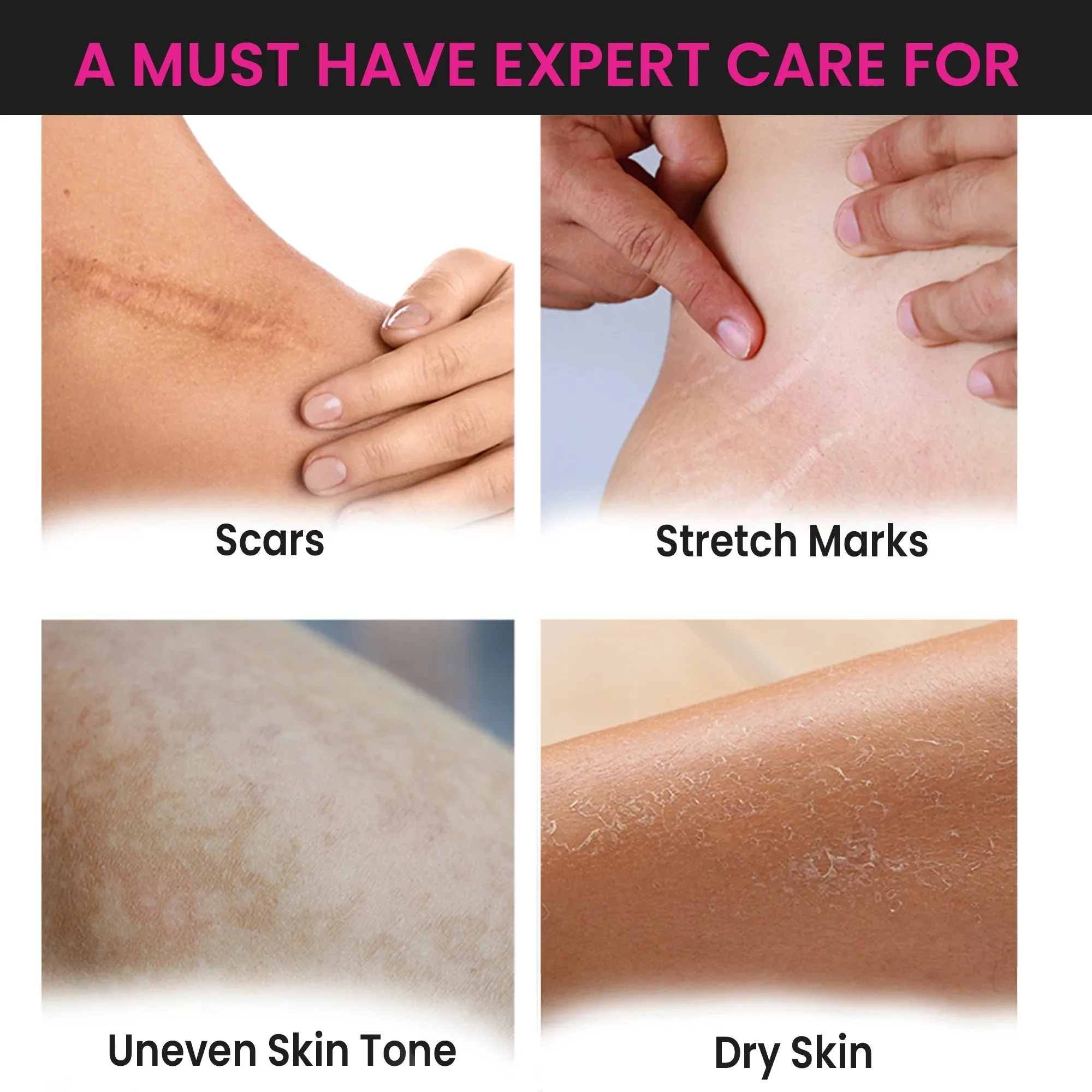 ThriveCo Skin Expert Skincare Oil For Face & Body | Fades Scars & Stretch Marks, Hydrates Dry Skin, Restores Skin Elasticity & Evens Skin Tone (80ml)