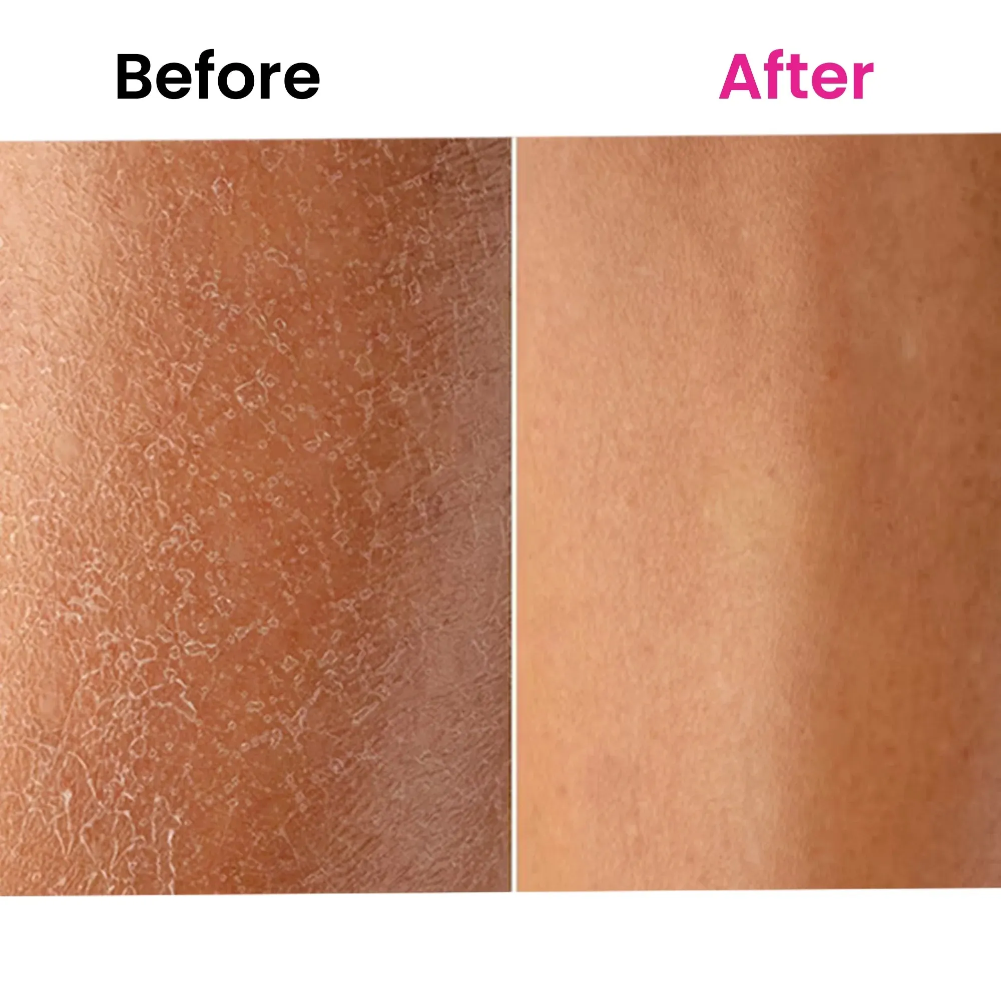 ThriveCo Skin Expert Skincare Oil For Face & Body | Fades Scars & Stretch Marks, Hydrates Dry Skin, Restores Skin Elasticity & Evens Skin Tone (80ml)